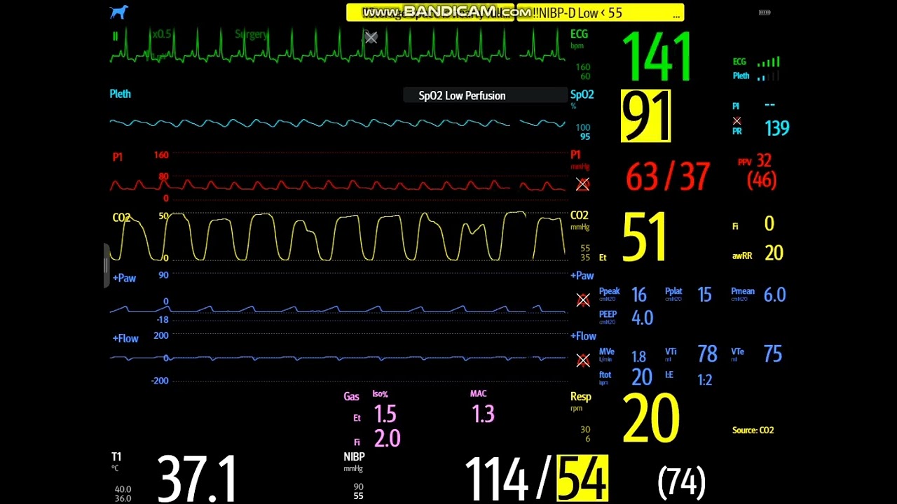 Massive Hemorrhage During Laparoscopic Liver Lobectomy in a 12-Year-Old Dachshund