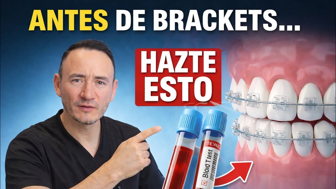 ¡NO te pongas brackets sin estos 5 exámenes!