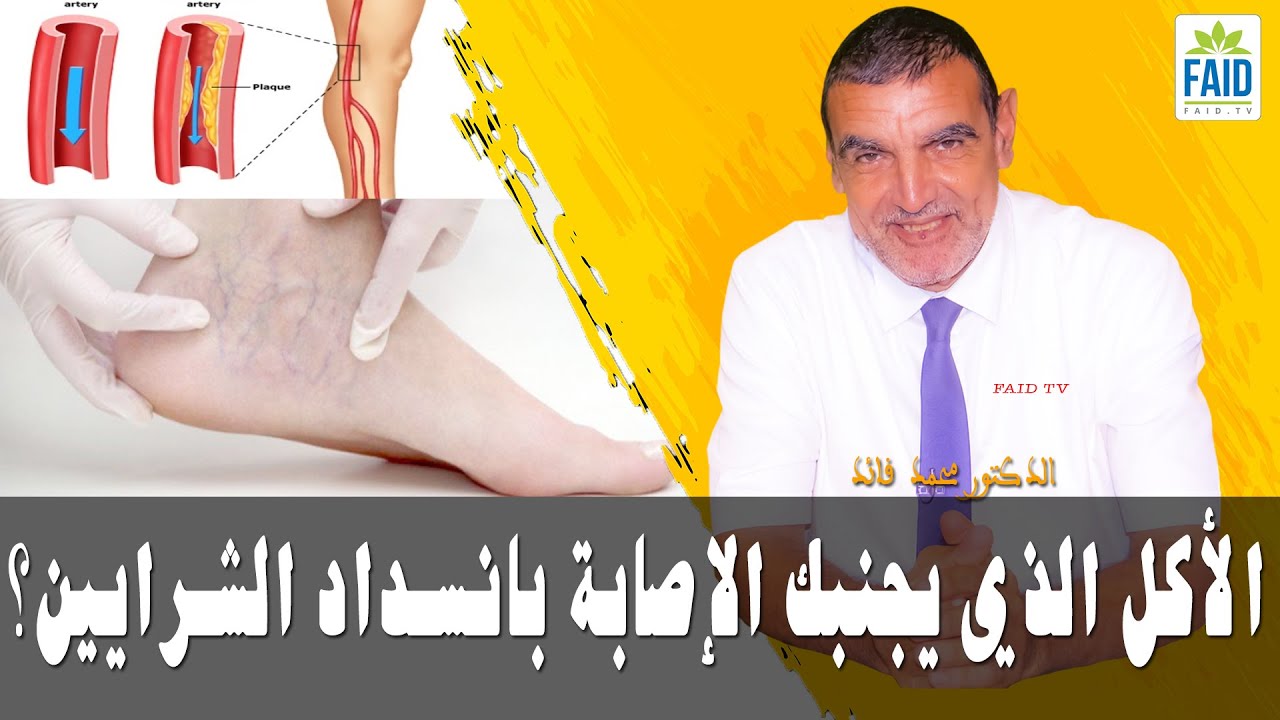 الأكل الذي يجنبك الإصابة بانسداد الشرايين؟ | الدكتور الفايد