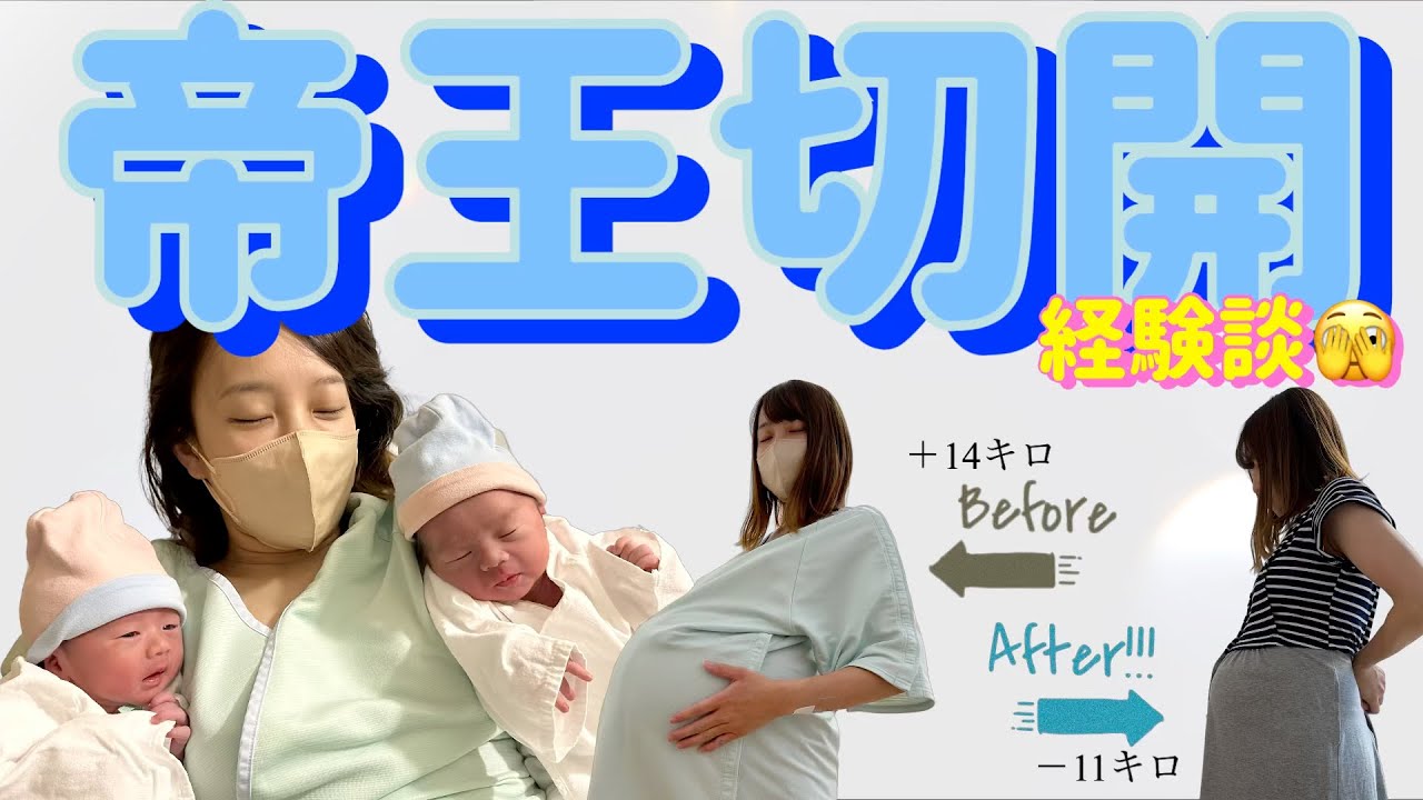 𓊆出産𓊇帝王切開で双子産みました💓1日で-11キロ減も！！