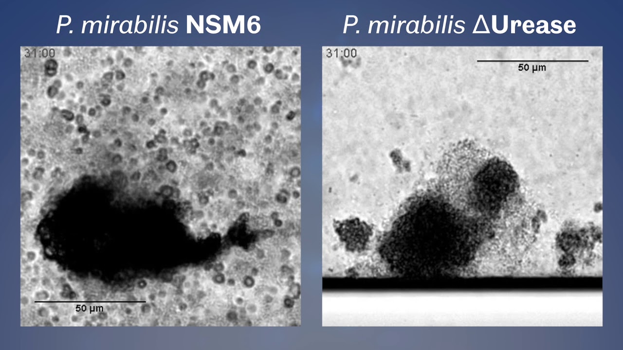 Proteus mirabilis Biofilms - Strain comparison