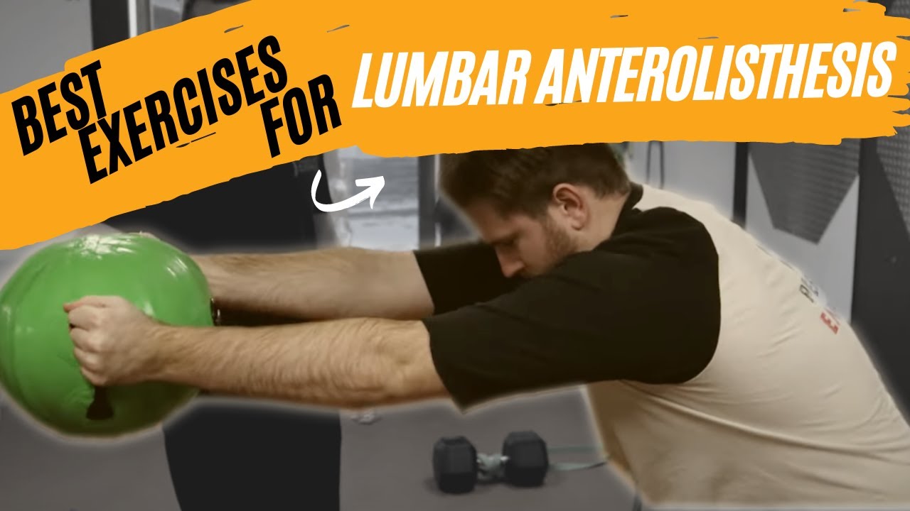 Best Exercises for Lumbar Anterolisthesis