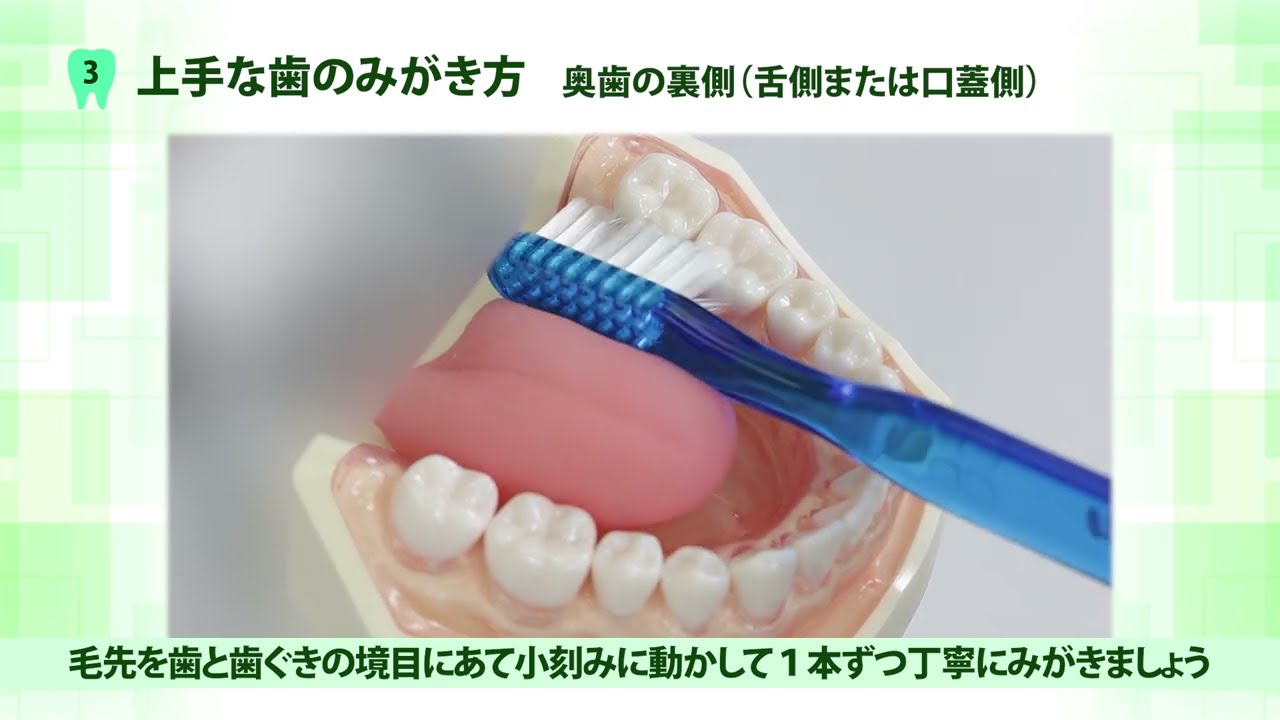 上手な歯のみがき方(成人編）