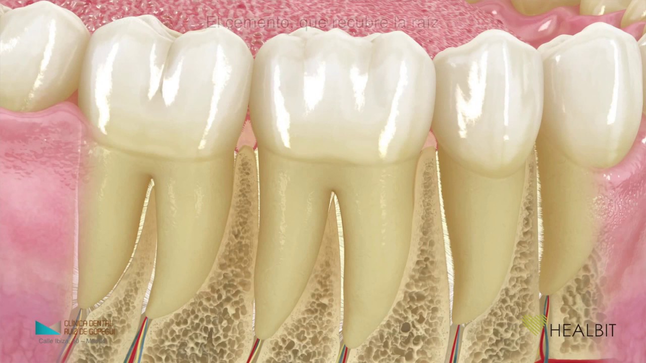 &iquest;Qu&eacute; es el Periodonto? - Cl&iacute;nica Dental Ruiz de Gopegui