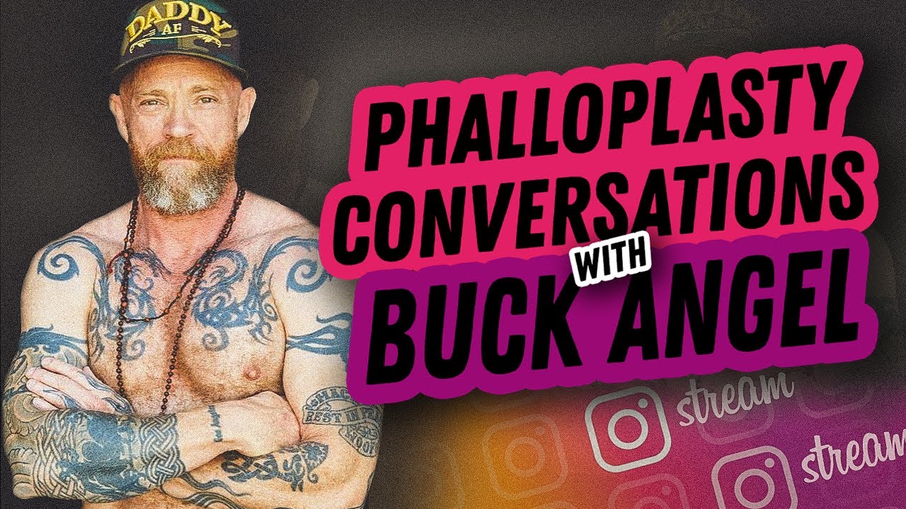 Radial Forearm Free Flap Surgery. Phalloplasty Conversations with Buck Angel.  Part 2.