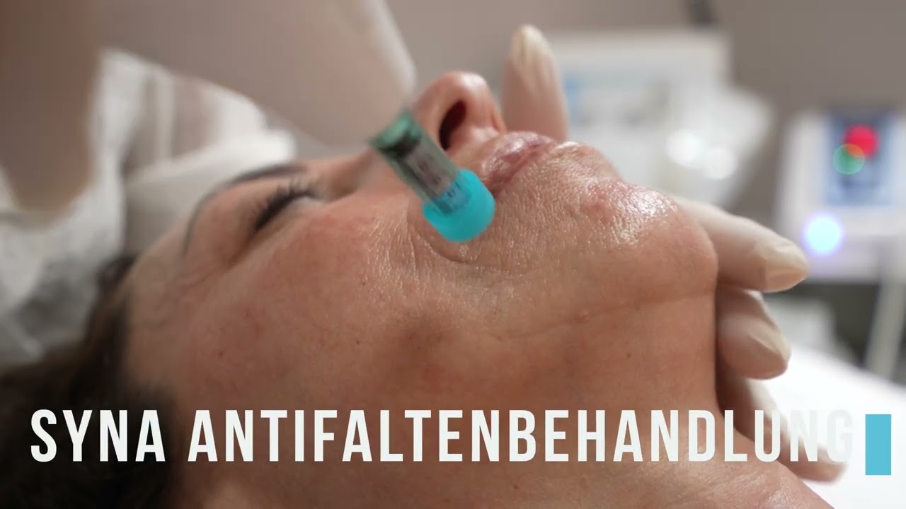 Technik, die die Haut begeistert! Syna AntiFaltenbehandlung