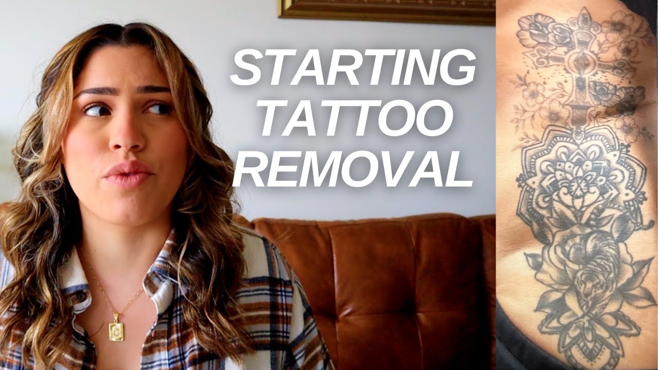 My Tattoo Removal at REMOVERY | Tattoo Removal Part 1