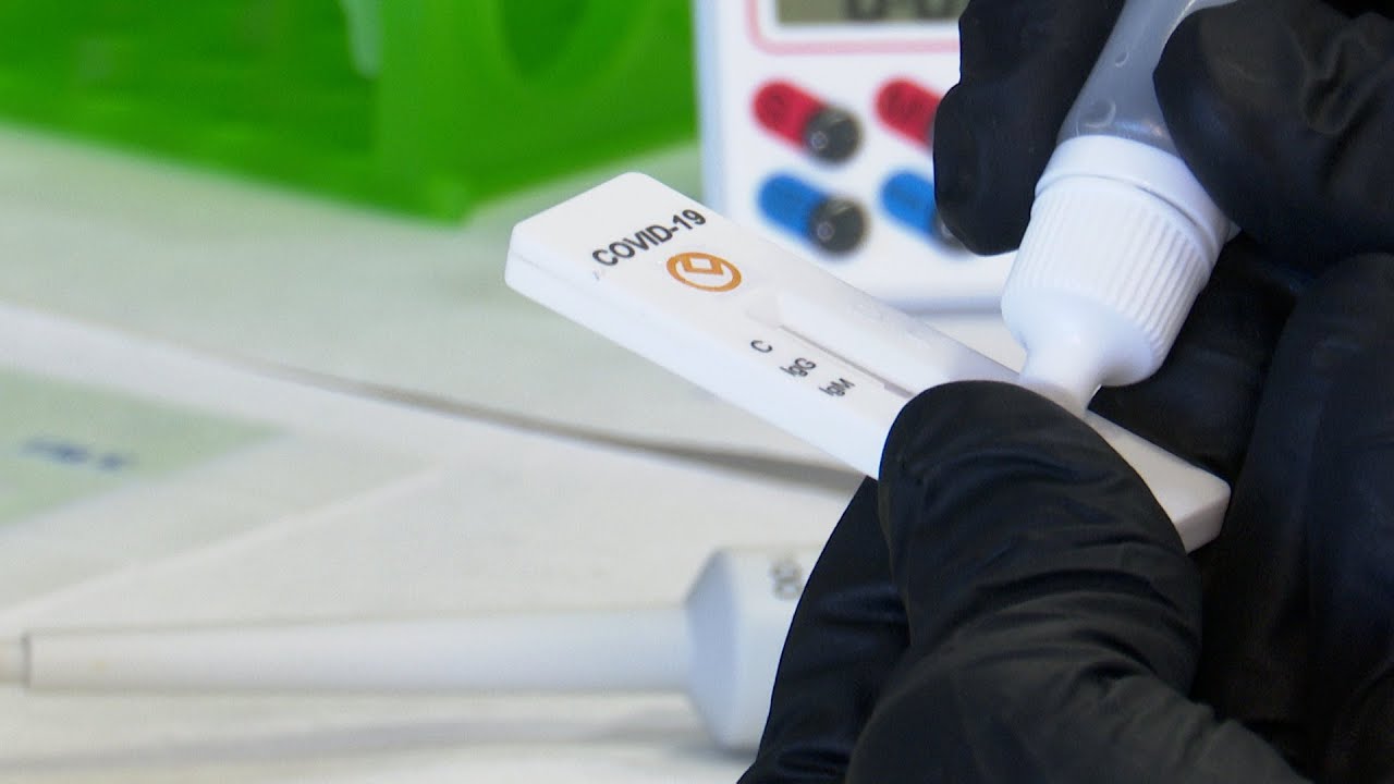 Crean un test r&aacute;pido de anticuerpos con una sensibilidad del 98%