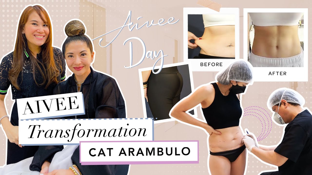 SURGICAL MAKEOVER OF CELEBRITY INFLUENCER CAT ARAMBULO | AIVEE TRANSFORMATION