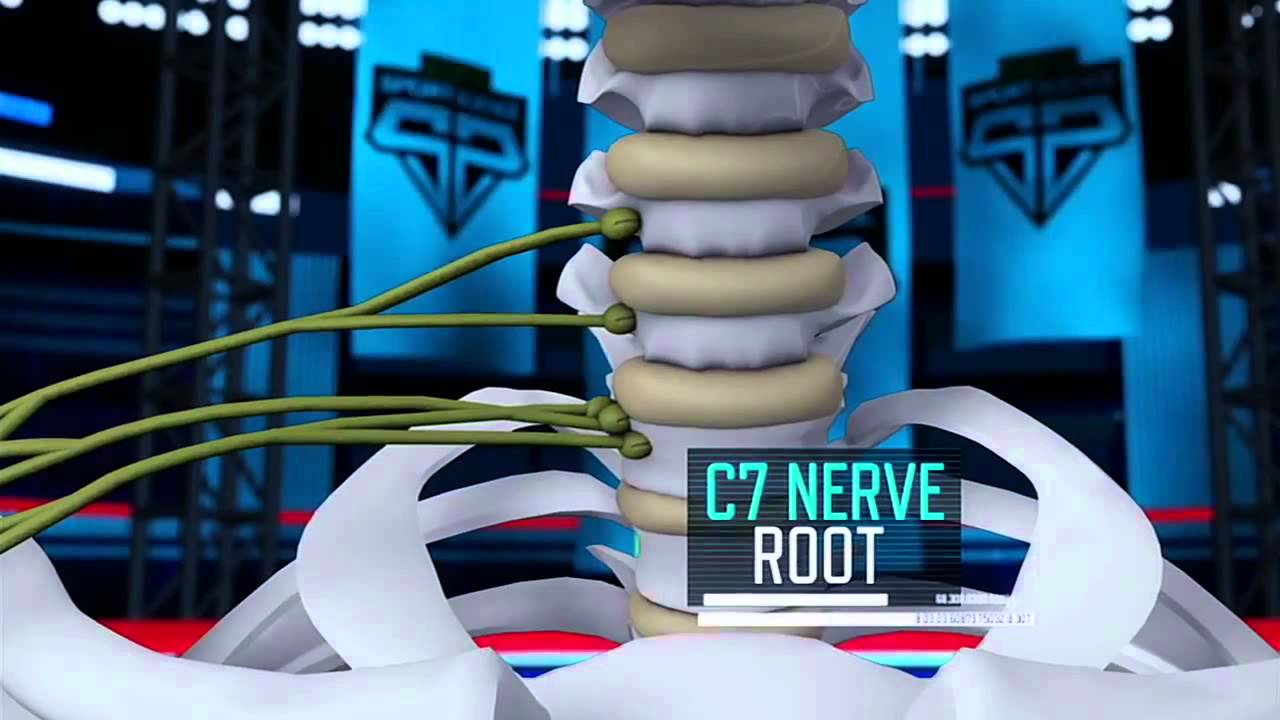 Sports Science: Peyton Manning's Neck Injury