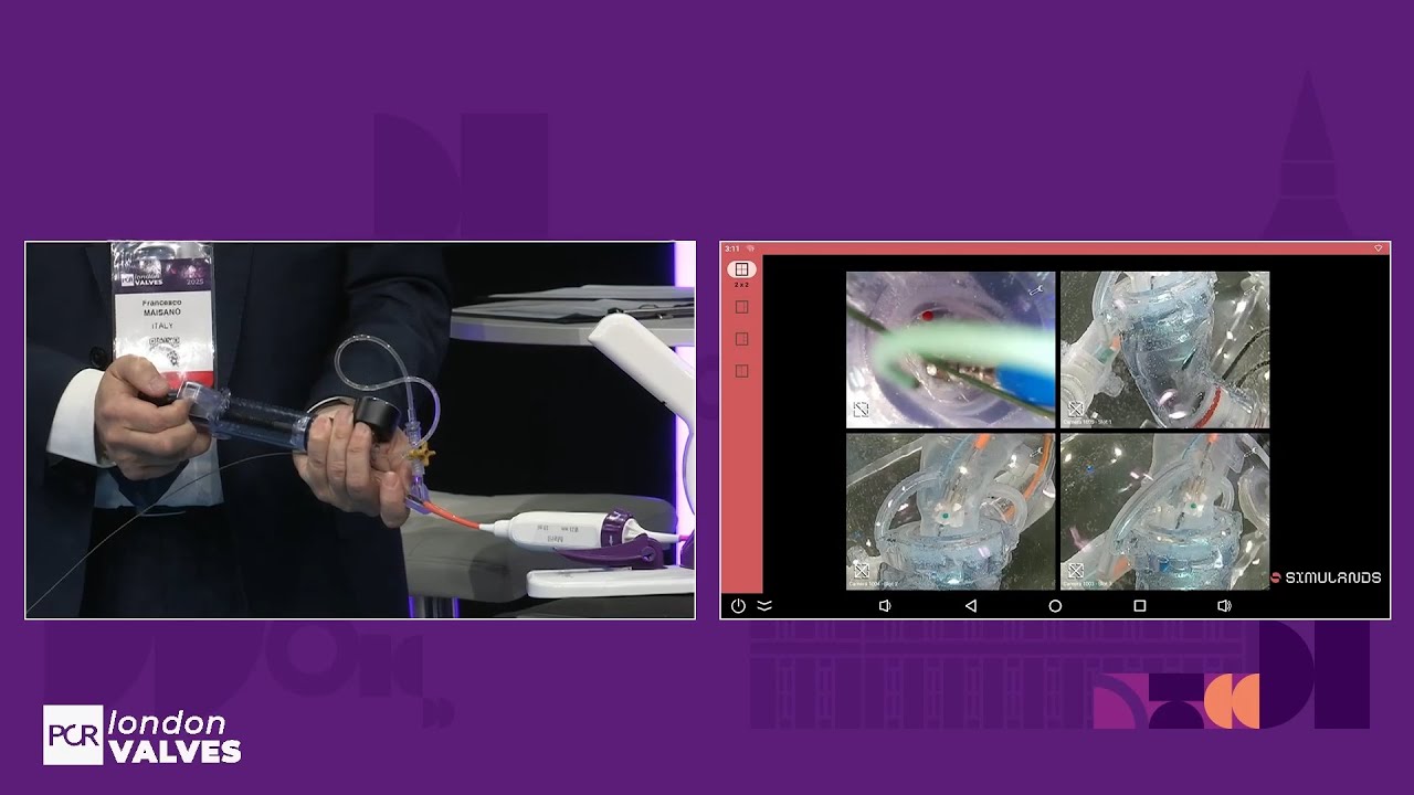 Meet with Myval THV series with real world case-based learning - PCR London Valves 2025