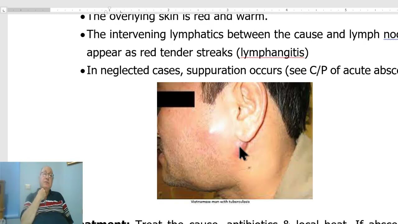 Lymphatic disorders in Arabic 5 (Lymphadenopathy ) , by Dr. Wahdan
