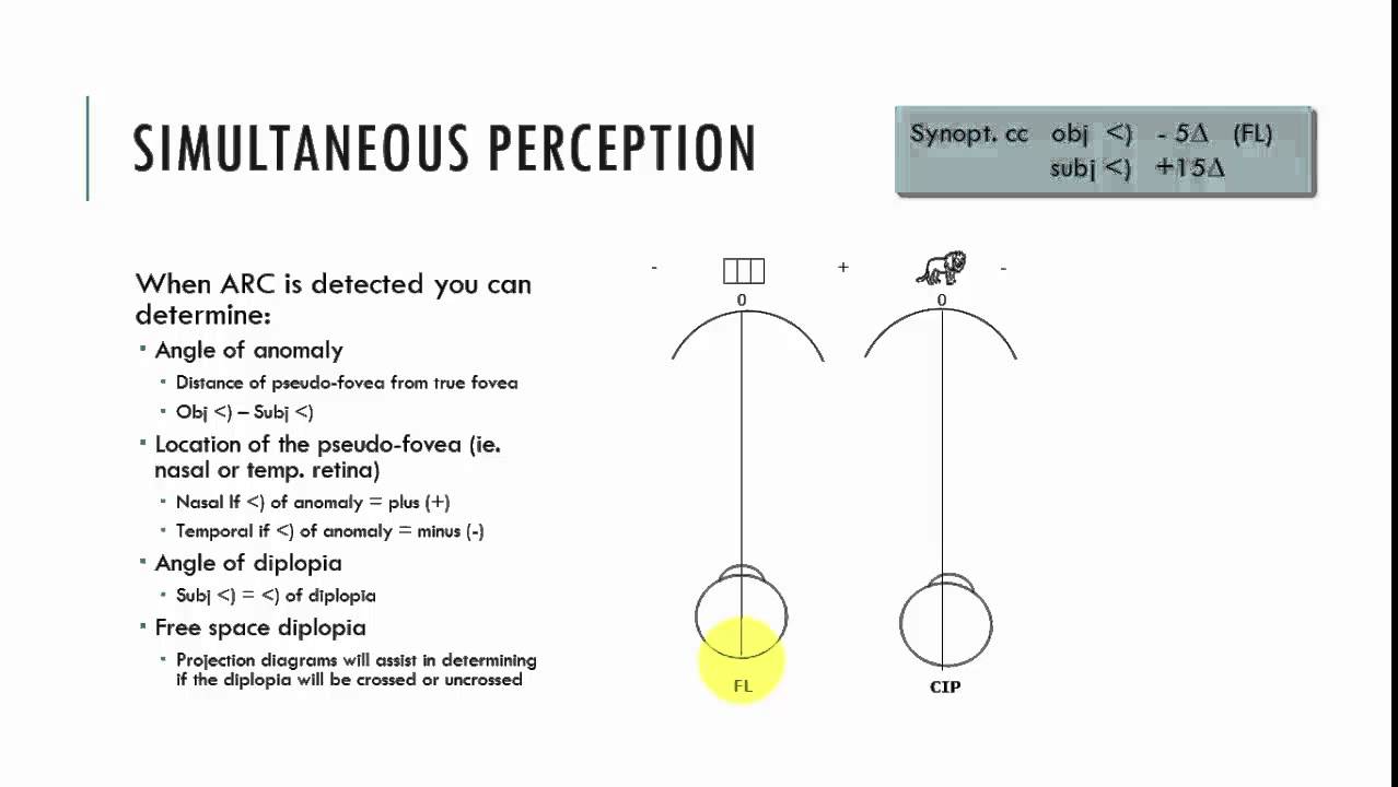 Synoptophore: Interpretation