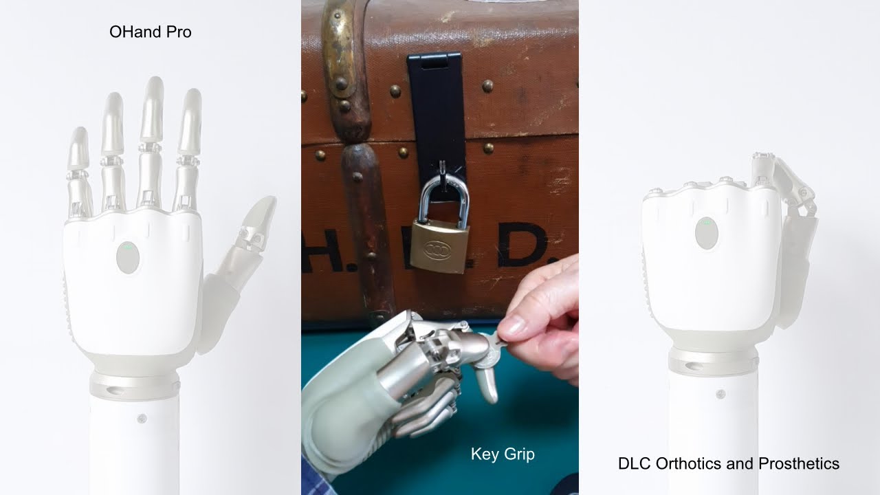 AI Prosthetic Hand with 27 Grip Patterns | Key