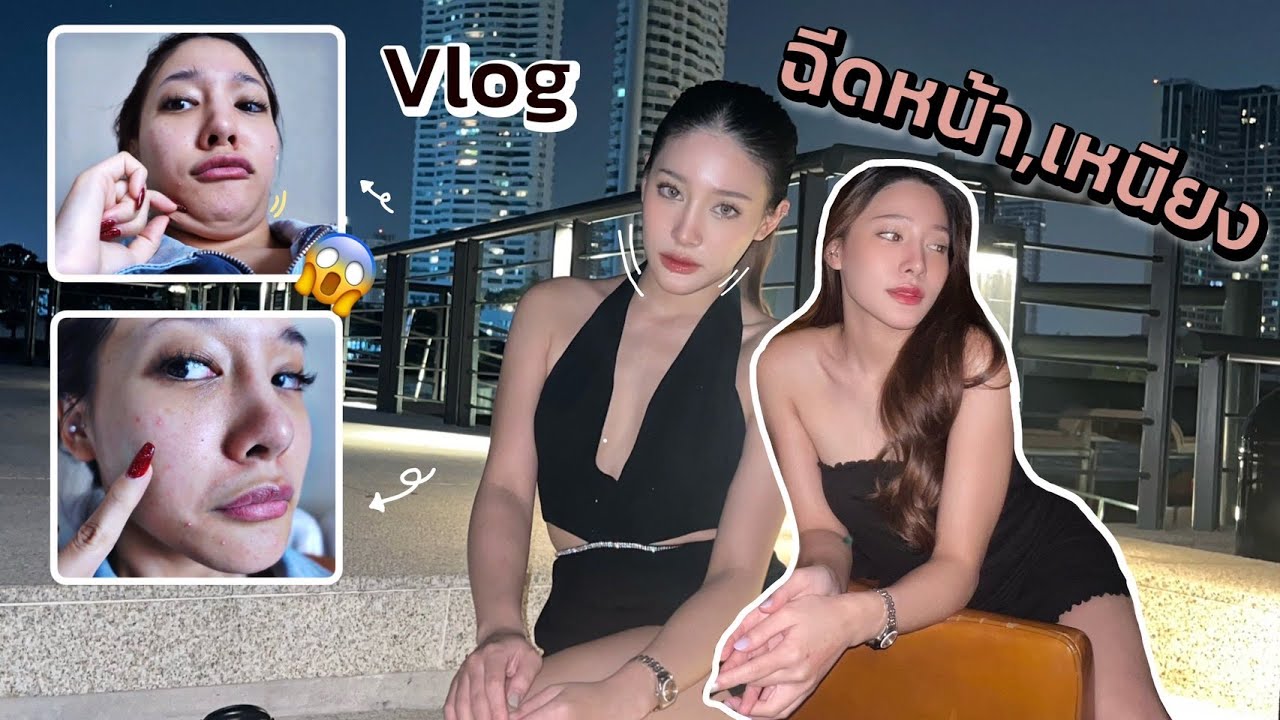 Self care day Vlog♡ พาไปฉีดหน้าใส,แฟตเหนียงงง เคล็ดลับนางฟ้า🧚🏻‍♀ | widpim withpim