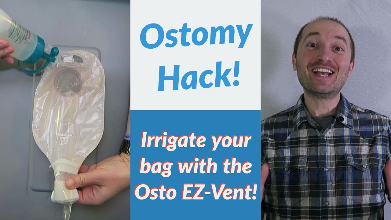Ostomy Hack: Irrigating Your Ostomy Bag Using the Osto-EZ Vent