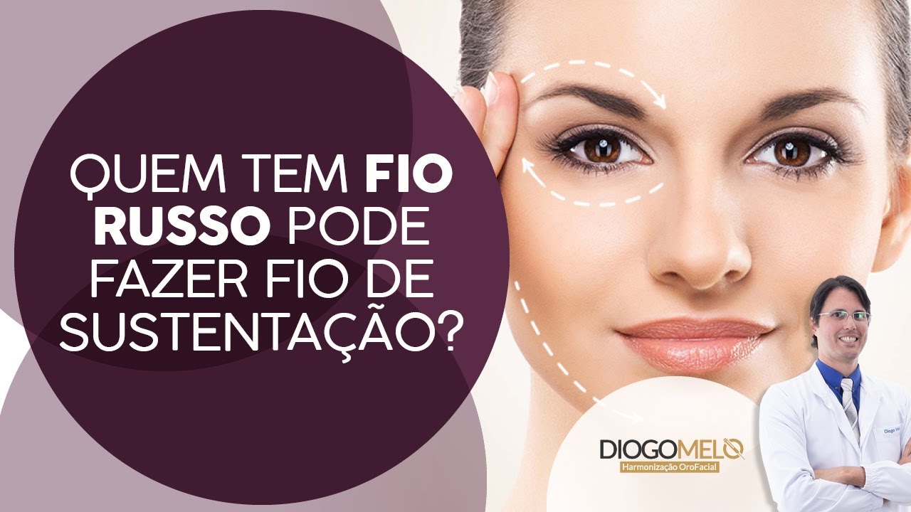 Quem tem Fio Russo pode fazer Fio de Sustenta&ccedil;&atilde;o?