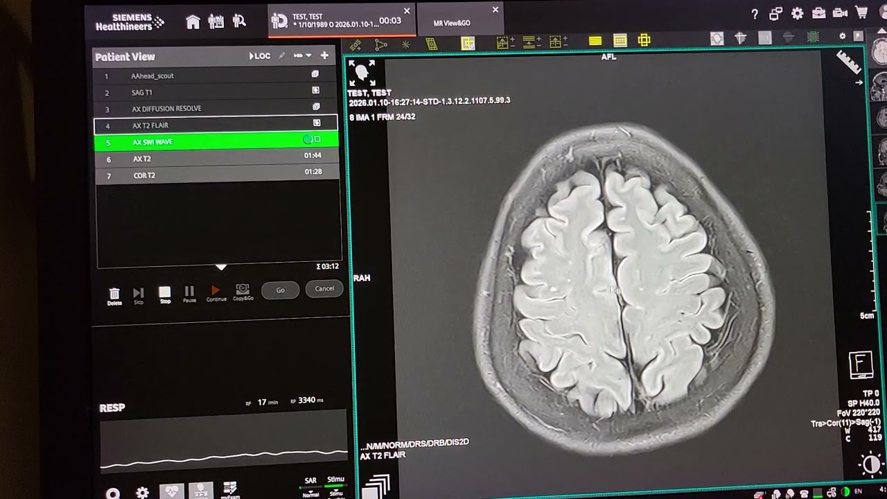 Performing Brain, Cspine, MRCP and shoulder MRIs Magnetom Vida 
