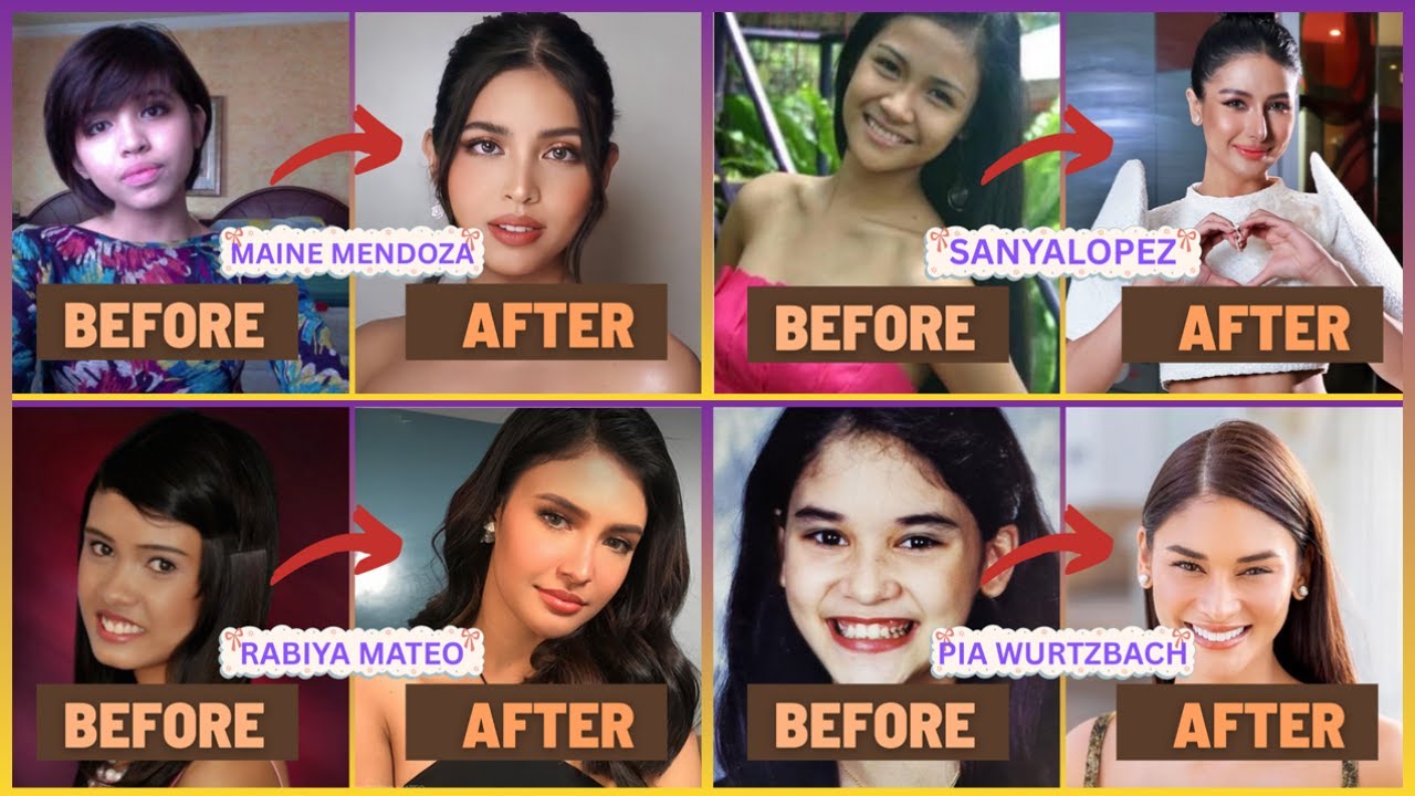 Pinoy Celebrities Before and After Retoke &ndash; Glow Up or Fake Up? 😱