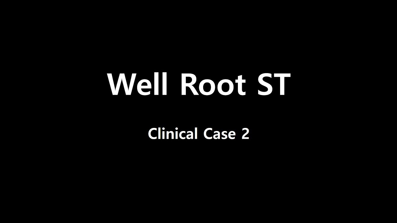 Well Root ST(Case2)