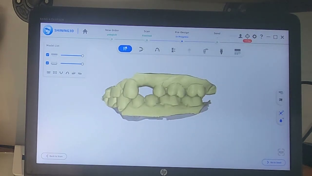 Triple Tray Scan with Shining 3d DS-EX Pro and Fabricating a Surgical Guide in Blue Sky Plan