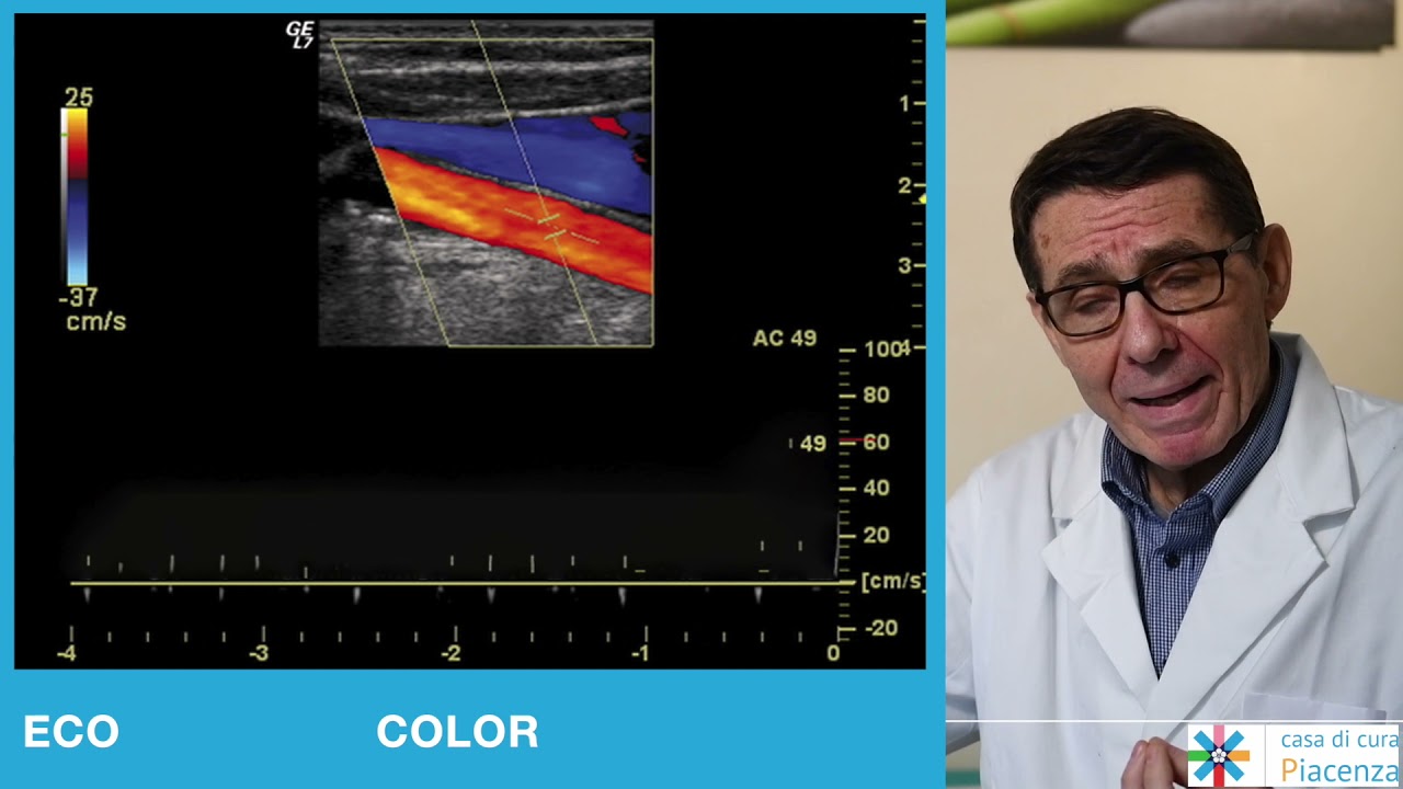 Dott. Guglielmo Fornasari - Eco-color-doppler