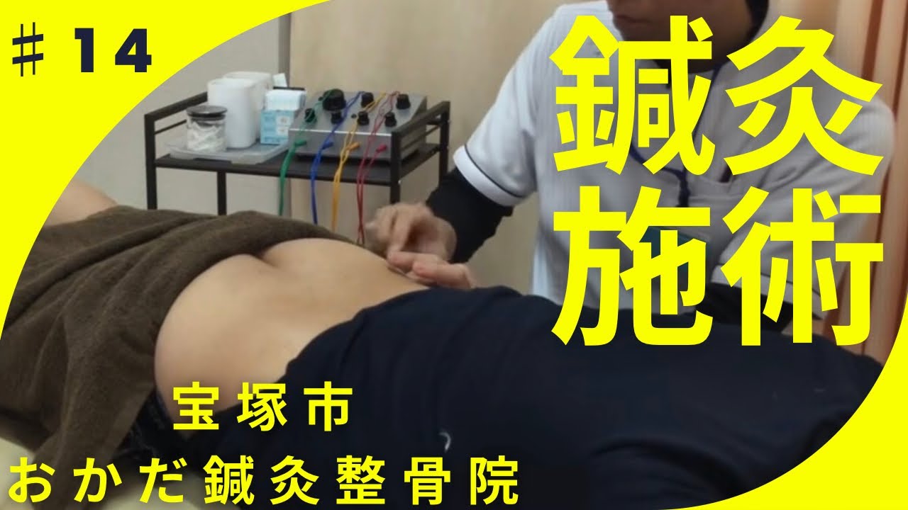 50代男性　坐骨神経痛で来院　仕事中も腰から足が痛かったが改善　電気鍼してみた|【宝塚市】おかだ鍼灸整骨院