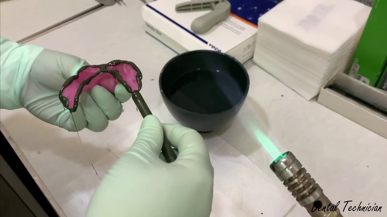 FINAL IMPRESSION - on a patient