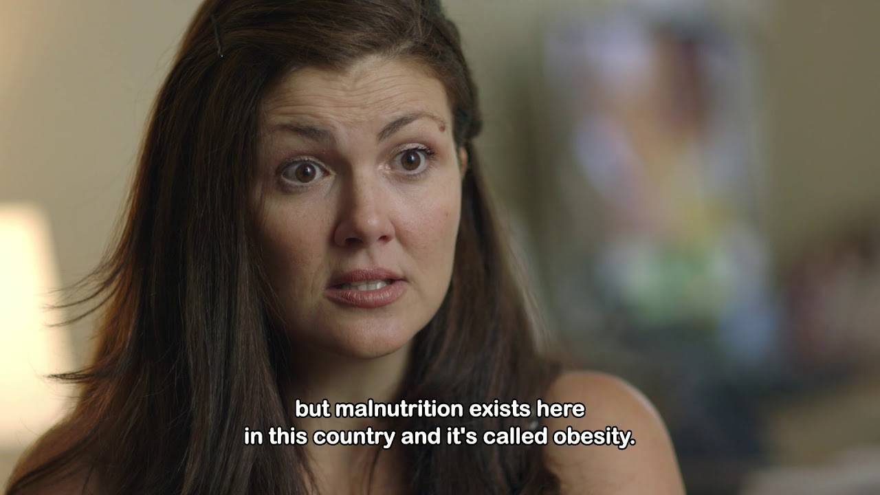 The many faces of child malnutrition