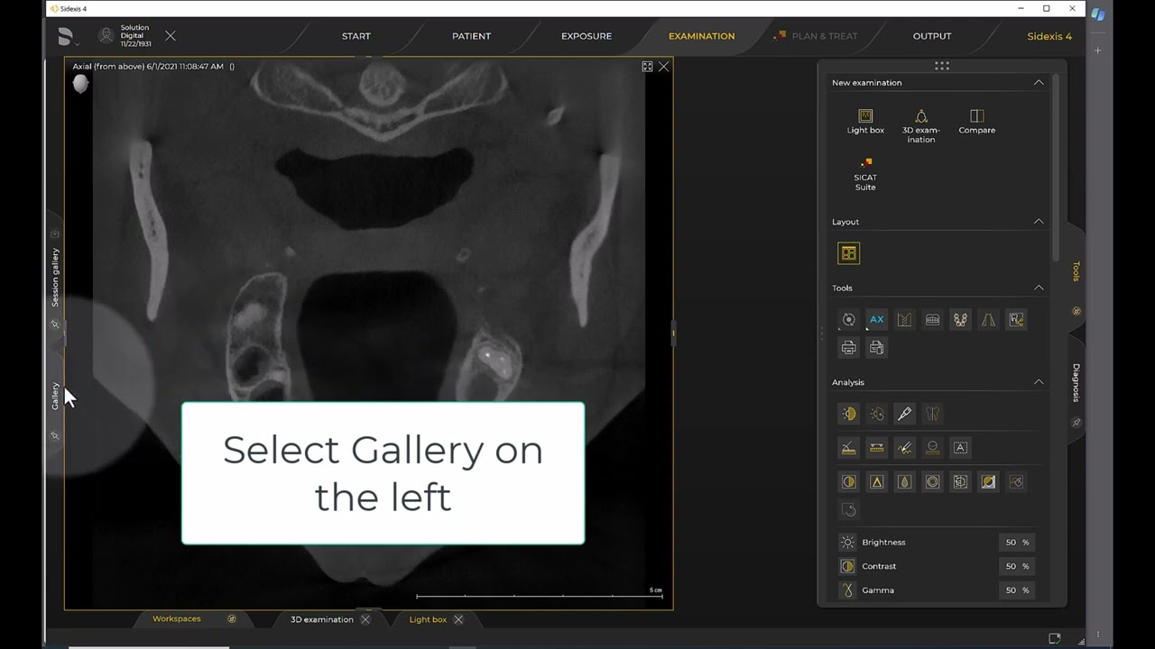 Imaging Training Session 32: Sidexis 4 – Creating a Presentation Session