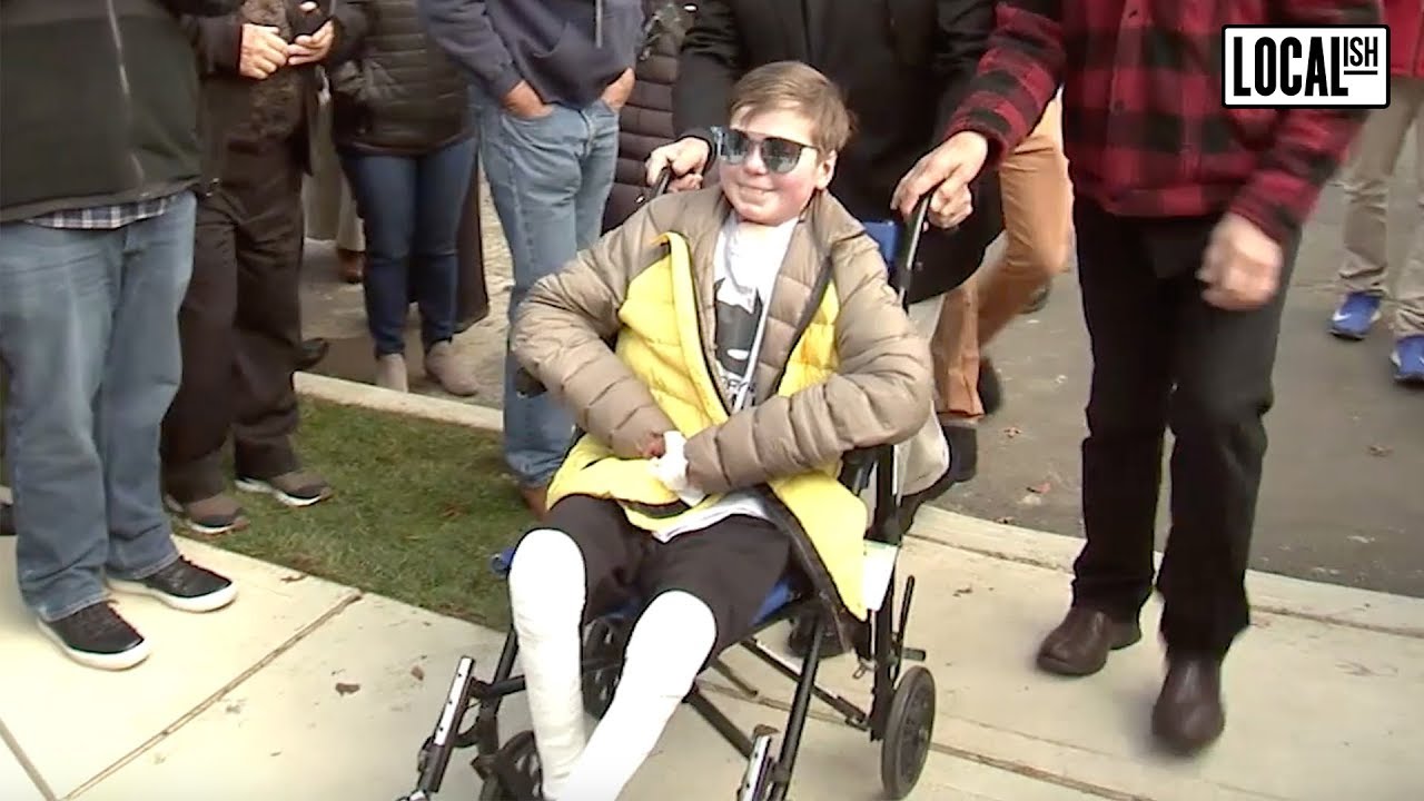 John Hudson Dilgen: Boy With Rare Skin Condition Gets New Smart Home | Localish