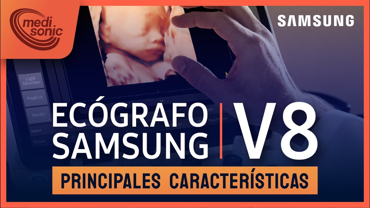 ECÓGRAFO SAMSUNG V8  💪😎 Principales características✨@medisonicperusamsung