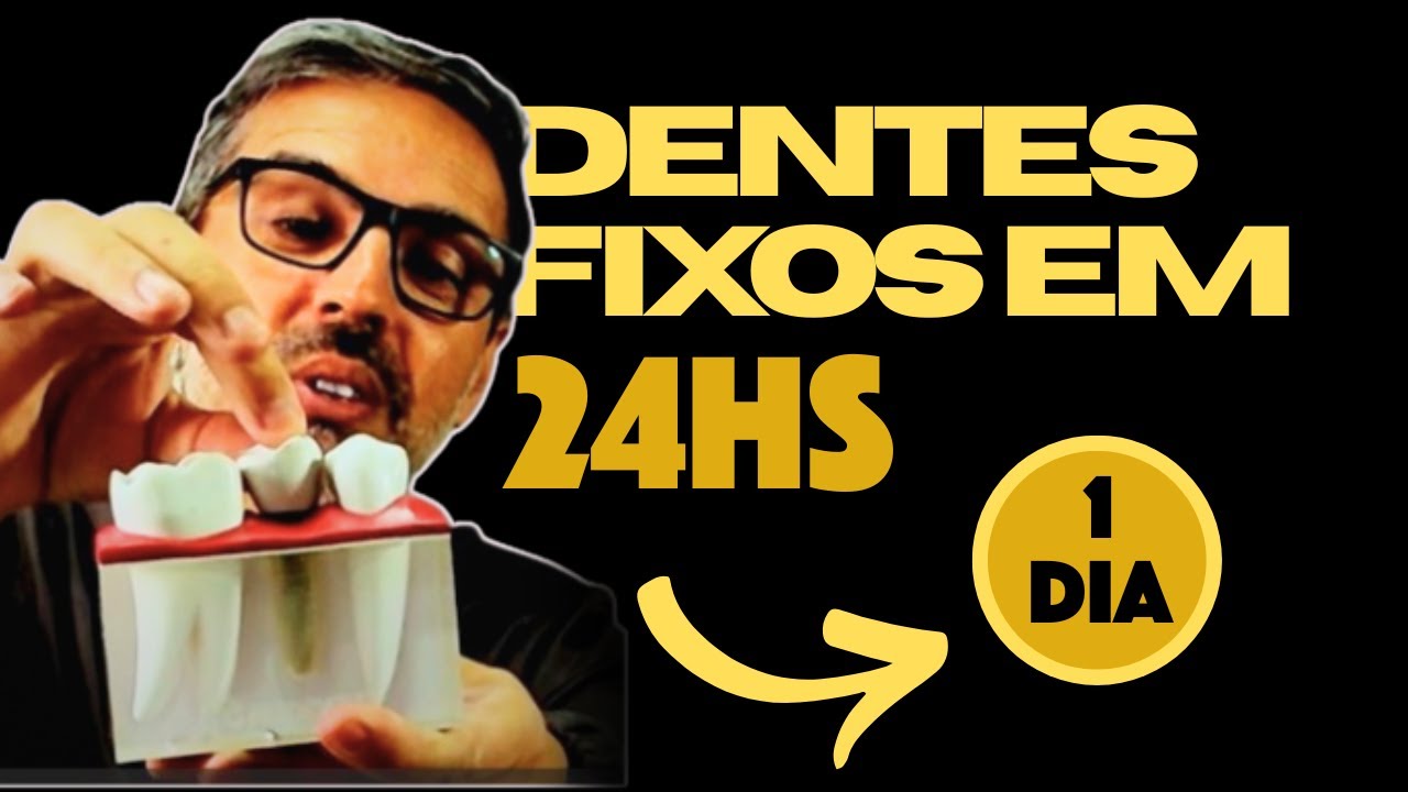 Todos Os Dentes Fixos em Implantes é a Melhor Solução Para Dentadura Frouxa