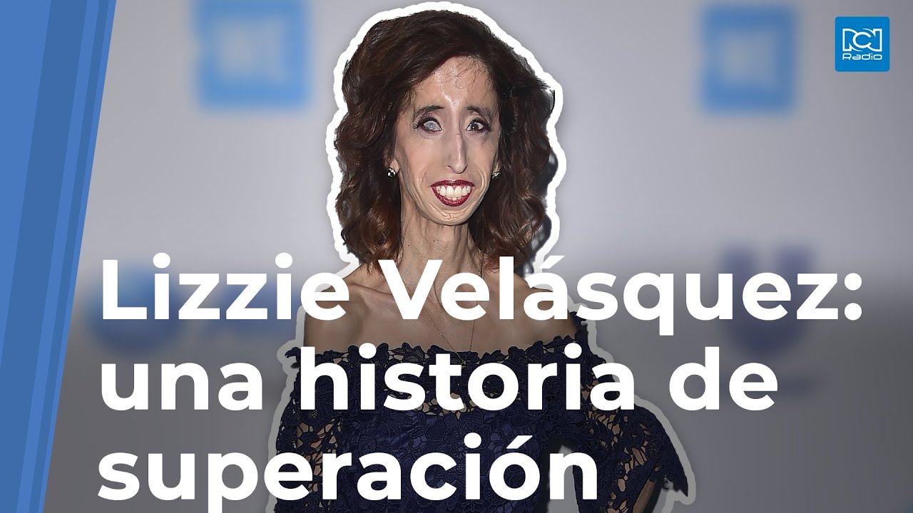 TiTok: Lizzie Velásquez se cansó de las bromas que hacen con sus fotos