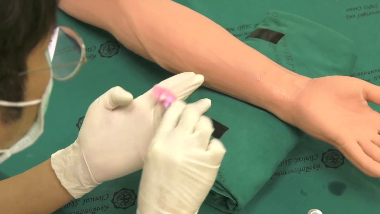 การเจาะ arterial blood gas