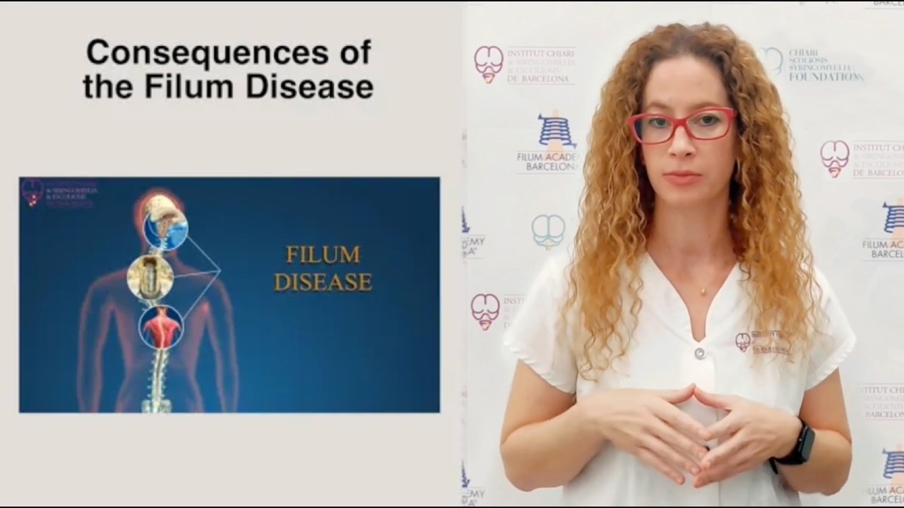 Presentation of ICSEB- Institut Chiari & Siringomielia & Escolioses de Barcelona