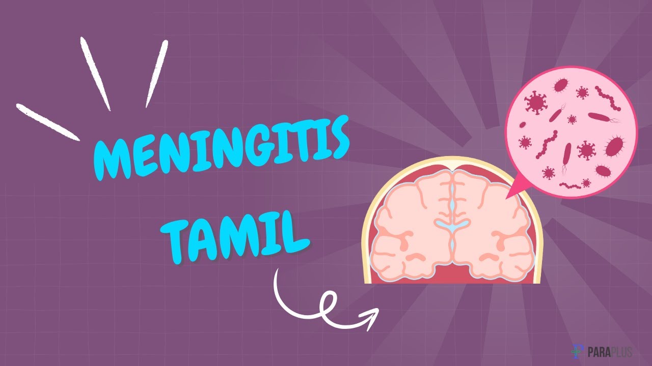 Meningitis in Tamil: Definition, Symptoms, Causes, Diagnosis, and Management #mrb #mrbtamil #rrb