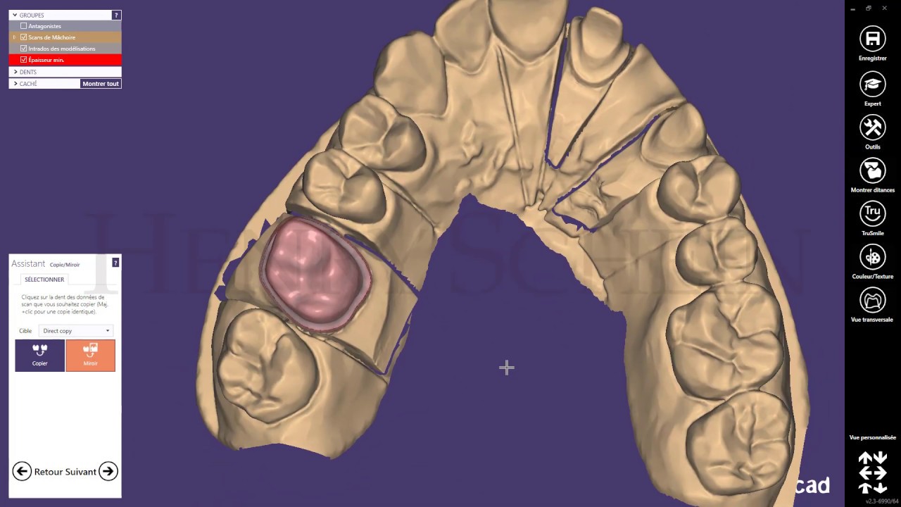Couronne avec Exocad
