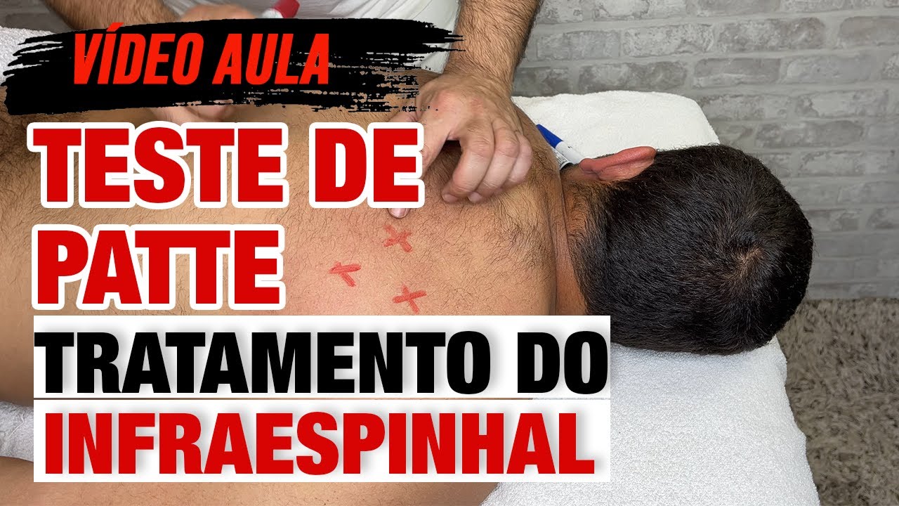 Tratamento Infraespinhal - Teste de Patte