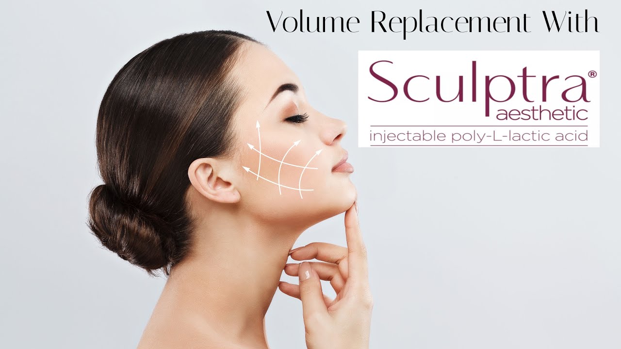 Volume Replacement with Sculptra Aesthetic  #masterinjector #sculptra #filler