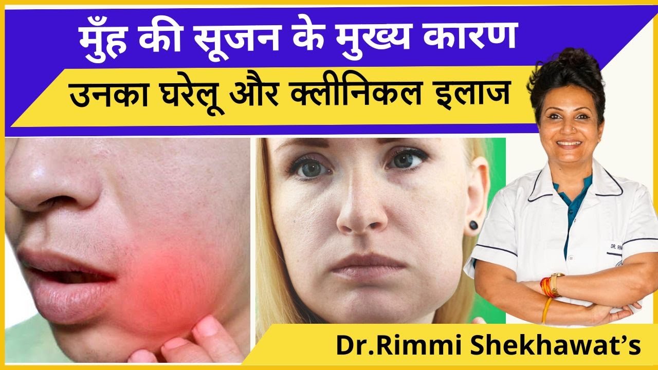मुँह की सूजन के मुख्य कारण और उनका घरेलू और क्लीनिकल इलाज | Reasons of facial swelling