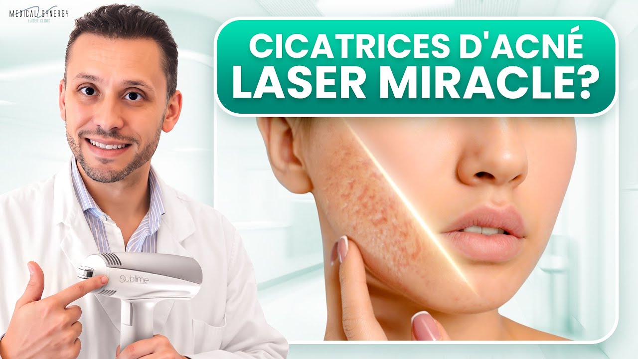 La Vérité Choquante sur les Cicatrices d'Acné et les Traitements au Laser