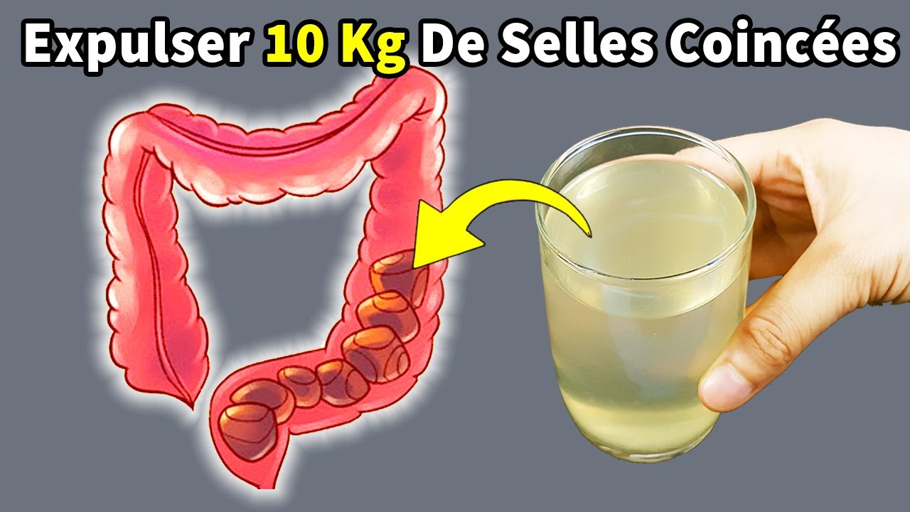Expulser Jusqu&rsquo;&agrave; 10 Kg De Selles Coinc&eacute;es Dans Les Intestins Et Vider L&rsquo;estomac Avec Cette Boisson