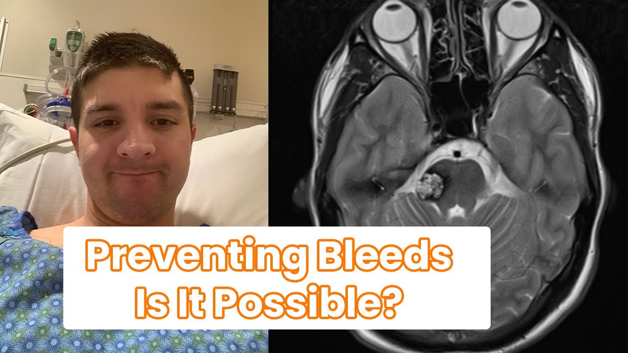 Cavernous Malformations Preventing Bleeds