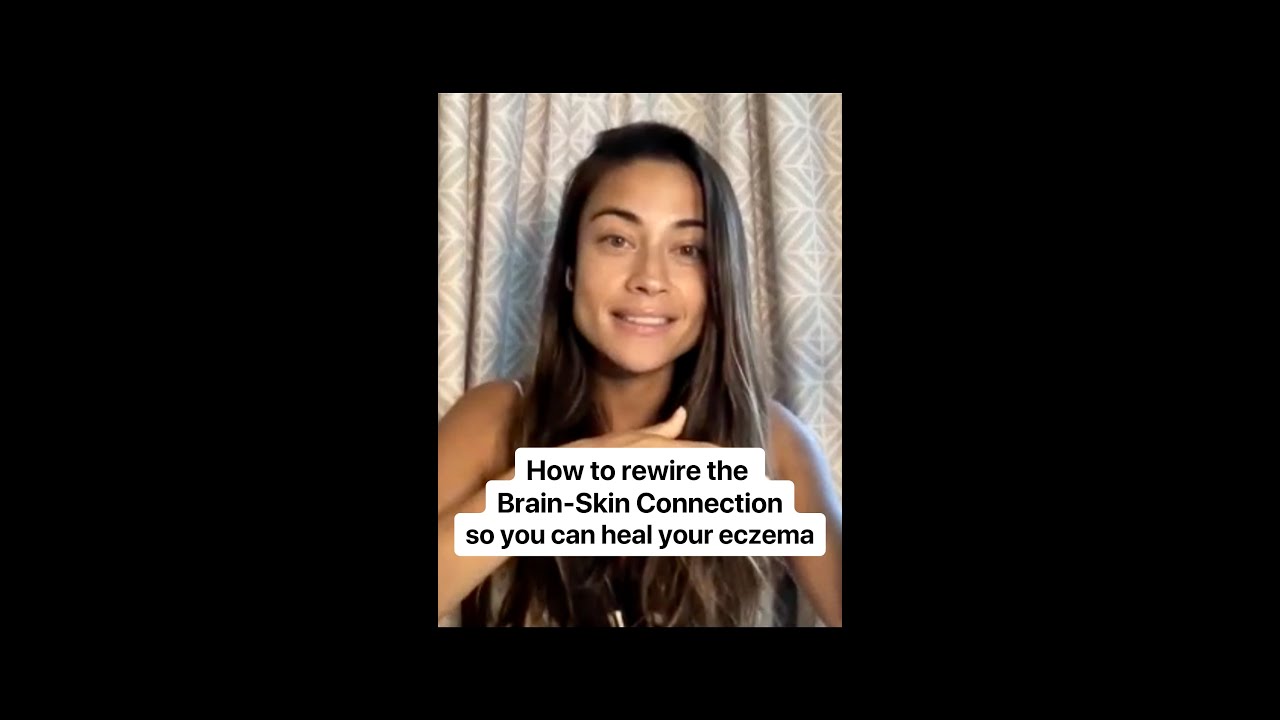 How to rewire the Brain-Skin Connection so you can heal your Eczema