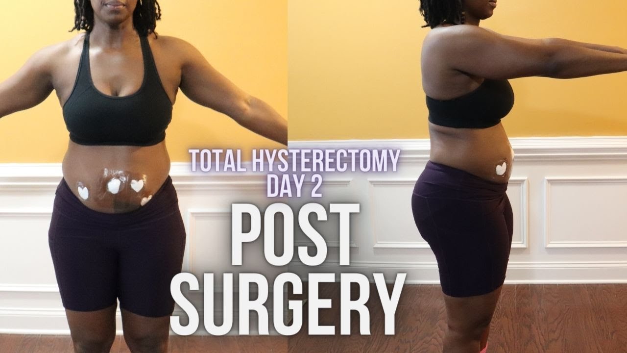 DAY 2 POST HYSTERECTOMY RECOVERY | Laparoscopic Hysterectomy Due to Fibroids