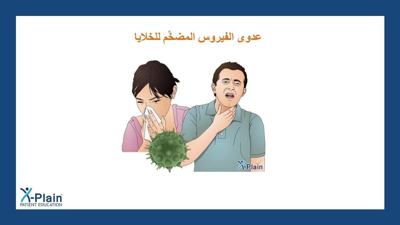 عدوى الفيروس المضخِّم للخلايا