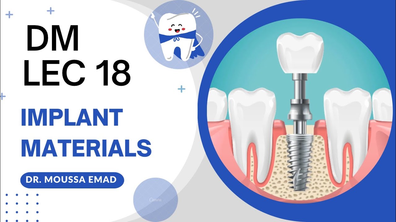 لكجر 18 دي ام | Dental implant material | طب اسنان مرحلة ثانية
