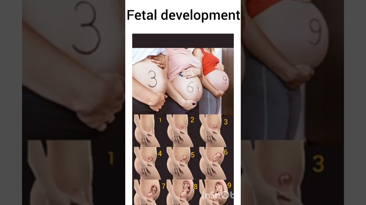 Fetus development #motivation #baby #fetalmovement #fetalmedicine #fetalcirculation