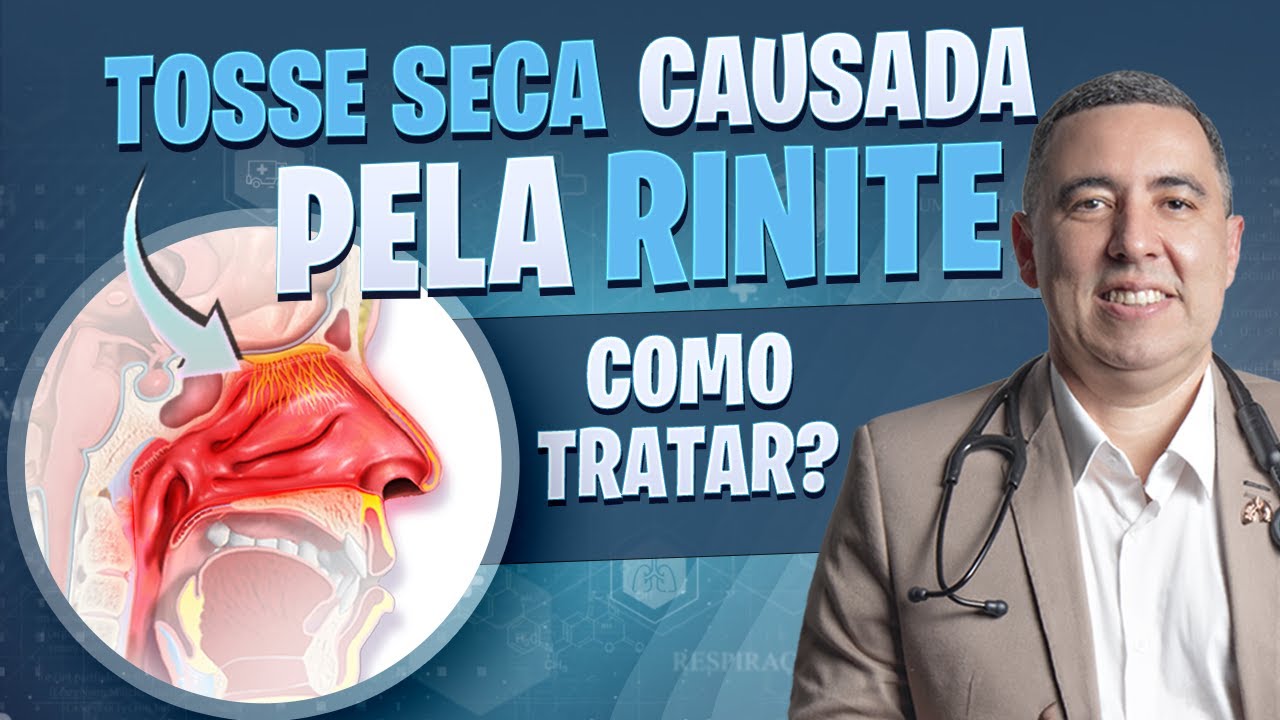 Como tratar a TOSSE SECA causada pela RINITE? Pneumologista responde